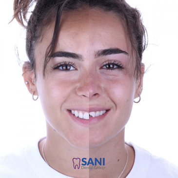 Slider image (2) Sani Dental Group Cancun